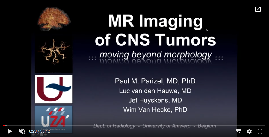 Imaging of CNS tumours (2017)