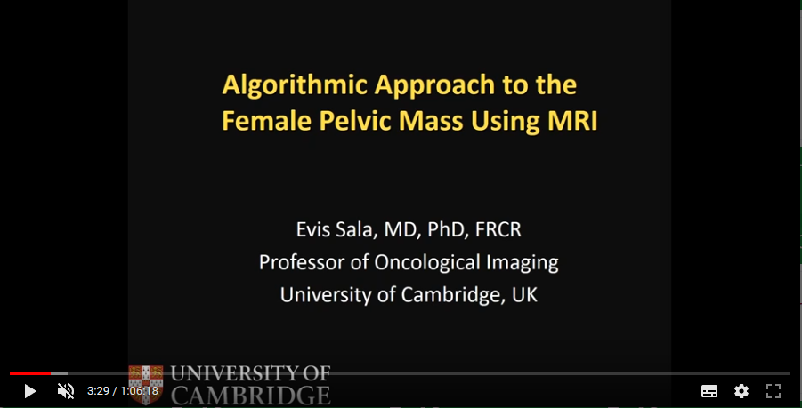 Algorithmic approach to the female pelvic mass (2018)