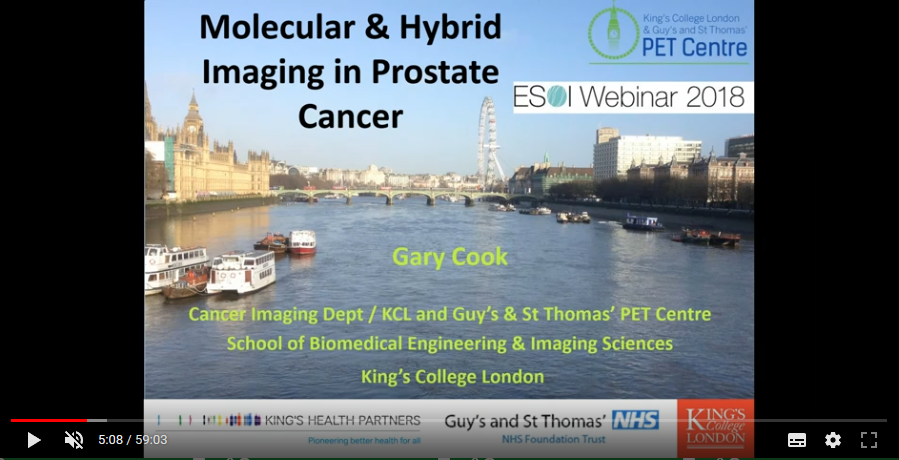 Molecular and hybrid imaging in prostate cancer (2018)