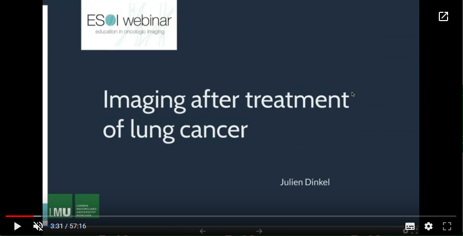 Imaging after treatment of lung cancer (2018)