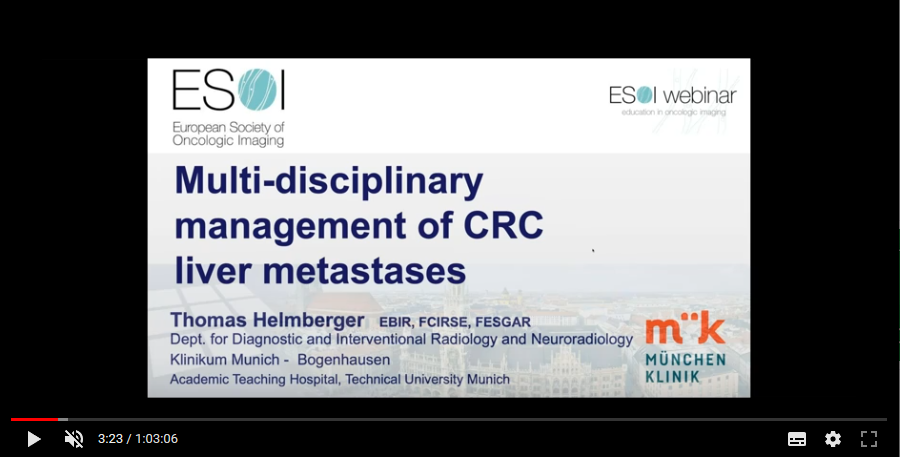 Multidisciplinary management of CRC liver metastases (2018)