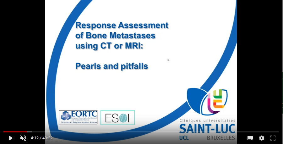 Assessment of the treatment response of bone lesions in cancer patients: Pearls and pitfalls (2018)