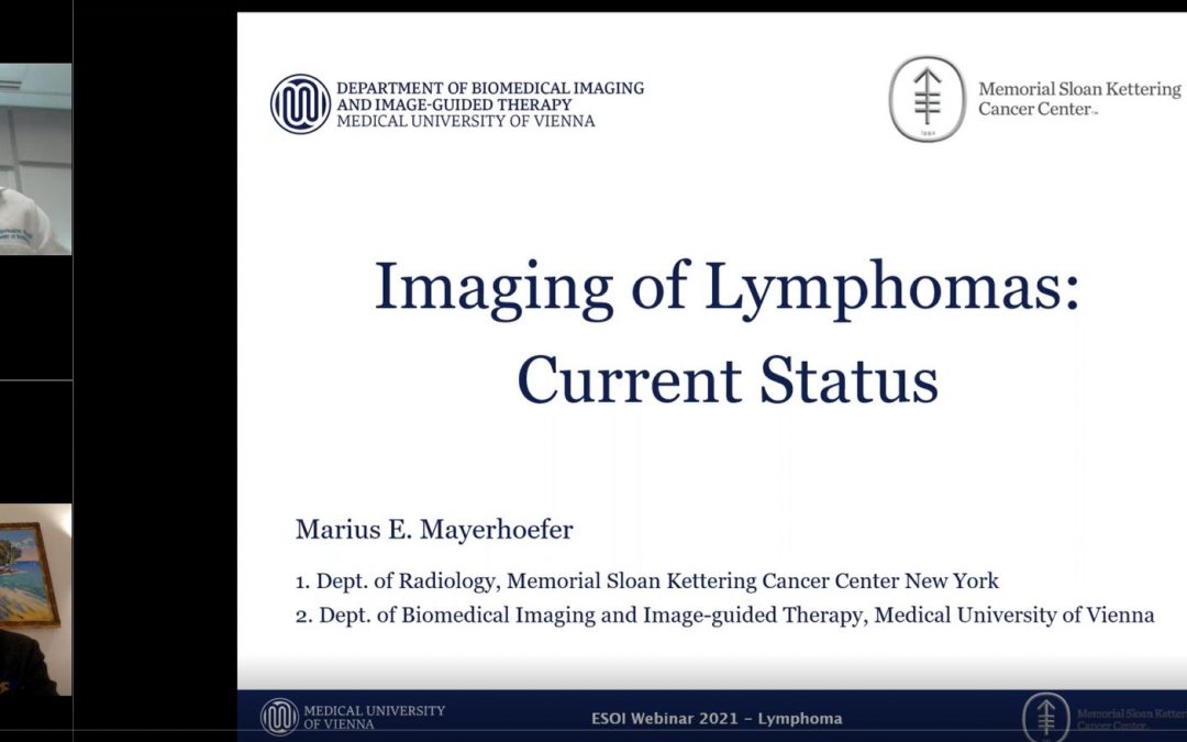 Imaging of lymphomas: Current status (2021)