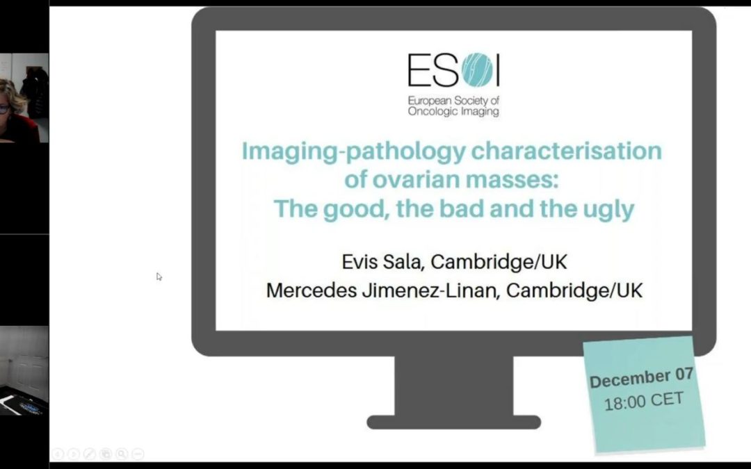 Imaging-pathology characterisation of ovarian masses: The good, the bad and the ugly (2021)