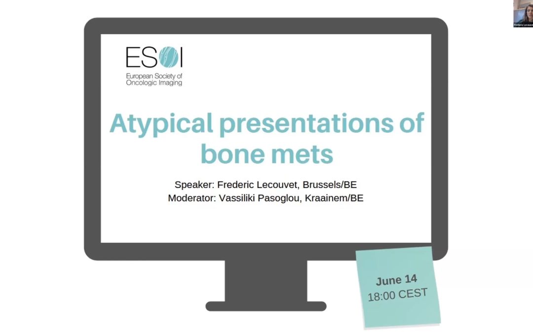 Atypical presentations of bone mets (2023)