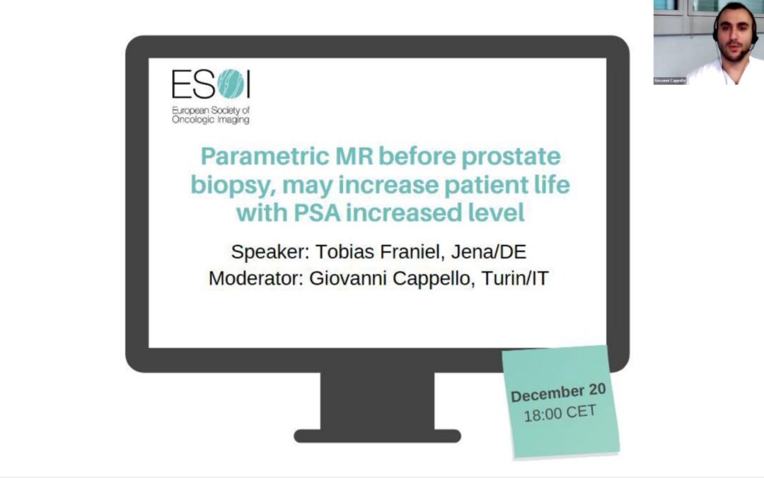 Parametric MR before prostate biopsy, may increase patient life with PSA increased level (2023)