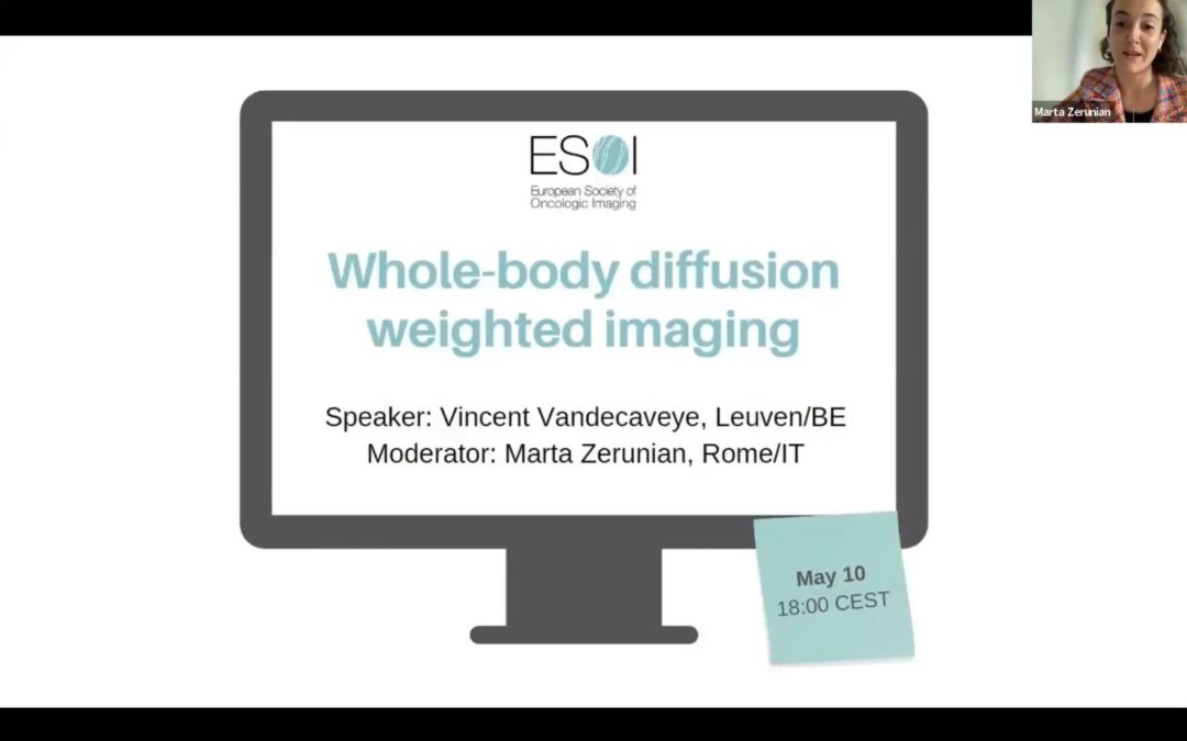Whole-body diffusion weighted imaging (2023)