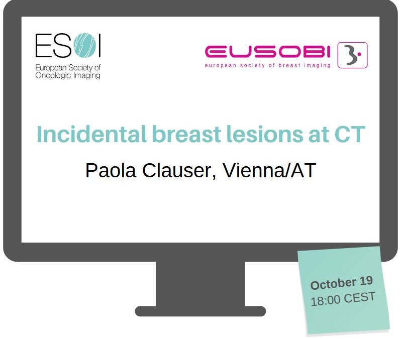 Incidental breast lesions at CT (2022)