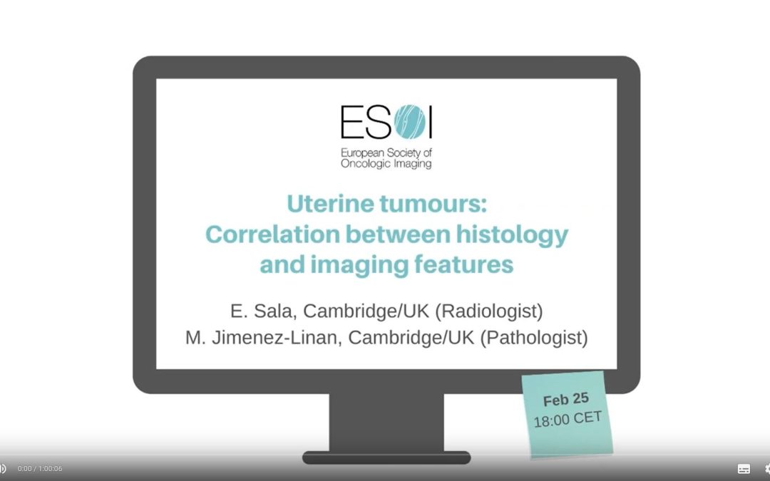 Uterine tumours: Correlation between histology and imaging features (2020)