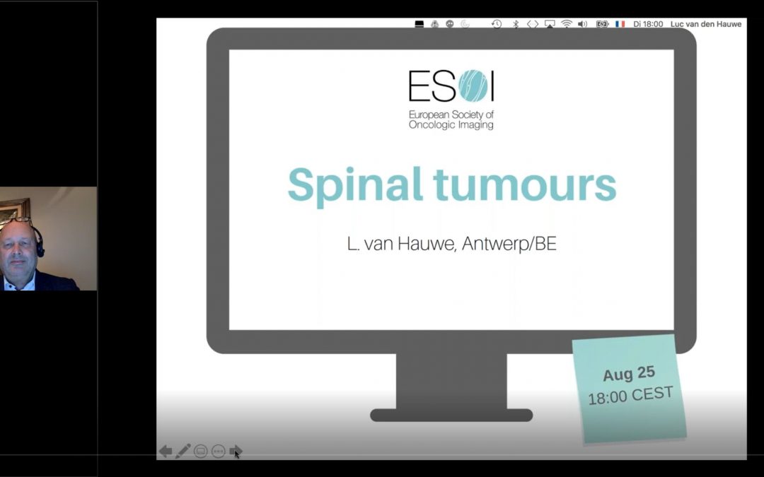 Spinal tumours (2020)